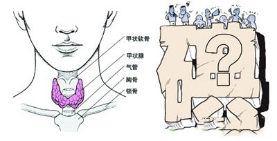 引起甲亢的原因?